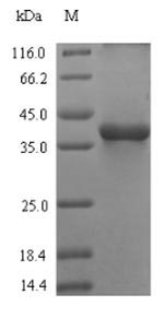 Recombinant Bovine Complement C3(C3),partial