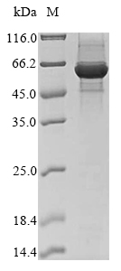 Recombinant Bovine Ferrochelatase, mitochondrial(FECH)