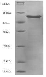 Recombinant Bovine Heterogeneous nuclear ribonucleoproteins A2/B1(HNRNPA2B1)