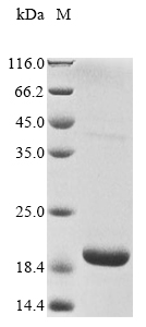 Recombinant Bovine Rhodopsin(RHO),partial