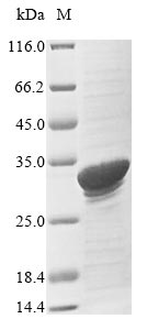 Recombinant Bovine Serum amyloid A protein(SAA1)