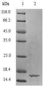 Recombinant Bovine Transforming growth factor beta-1 proprotein(TGFB1),partial