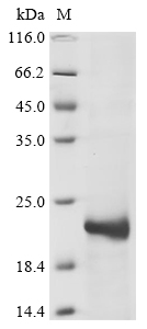Recombinant Calloselasma rhodostoma Snaclec rhodocytin subunit beta