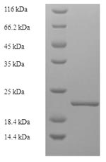 Recombinant Carpinus betulus Major pollen allergen Car b 1 isoforms 1A and 1B