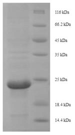 Recombinant Centruroides suffusus Beta-mammal toxin Css4