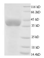 Recombinant Chicken Glyceraldehyde-3-phosphate dehydrogenase(GAPDH)