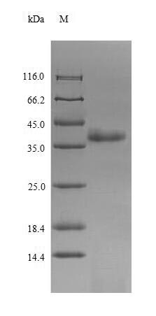 Recombinant Chicken anemia virus Apoptin(VP3)