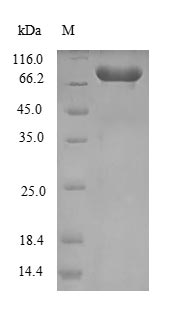 Recombinant Chlamydia trachomatis 60KDA chaperonin(groL)