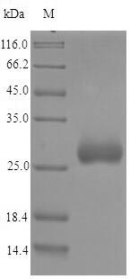 Recombinant Chlamydia trachomatis Small cysteine-rich outer membrane protein OmcA(OmcA)