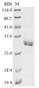 Recombinant Chlamydia trachomatis Virulence plasmid protein pGP3-D