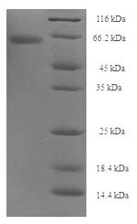 Recombinant Clostridium botulinum Botulinum neurotoxin type A(botA),partial
