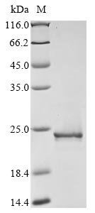 Recombinant Clostridium symbiosum Pyruvate, phosphate dikinase(ppdK),partial