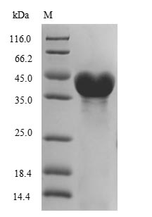 Recombinant Colwellia psychrerythraea DNA ligase(ligA),partial