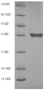 Recombinant Coptis japonica S-norcoclaurine synthase 2(PR10A)