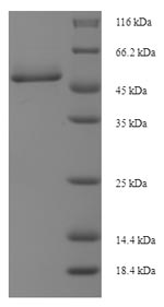 Recombinant Cricetulus griseus Cathepsin D(H671_3g9701),partial 