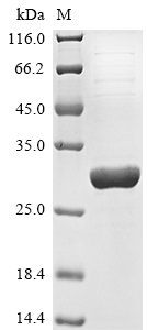 Recombinant Cricetulus longicaudatus Glutathione S-transferase P(GSTP1)