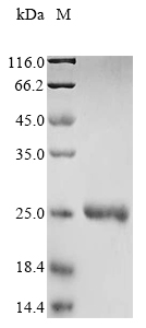 Recombinant Culex quinquefasciatus Odorant binding protein OBP28(6050687)