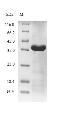 Recombinant Desulfotalea psychrophila DNA ligase(ligA),partial