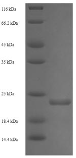 Recombinant Enterobacteria phage 933W Shiga-like toxin 2 subunit B(stxB2)