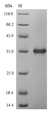 Recombinant Enterobacteria phage T4 Endolysin(E)