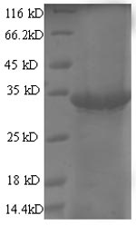 Recombinant Enterobacteria phage T7 Single-stranded DNA-binding protein gp2.5（2.5）