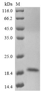 Recombinant Enterovirus A71 Genome polyprotein,partial
