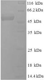 Recombinant Epstein-Barr virus Deoxyuridine 5'-triphosphate nucleotidohydrolase(BLLF3)