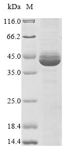Recombinant Epstein-Barr virus Replication and transcription activator(BRLF1),partial