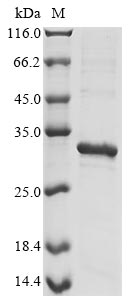 Recombinant Epstein-Barr virus Secreted protein BARF1(BARF1)