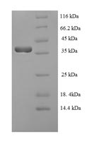 Recombinant Epstein-Barr virus Trans-activator protein BZLF1 (BZLF1)