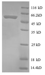 Recombinant Escherichia coli 30S ribosomal protein S2(rpsB)
