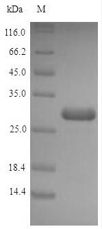 Recombinant Escherichia coli Acyl carrier protein(acpP)
