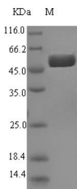 Recombinant Escherichia coli Agmatinase(speB)