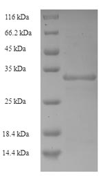 Recombinant Escherichia coli CS6 fimbrial subunit B(cssB)