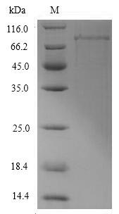 Recombinant Escherichia coli Chaperone protein DnaK(dnaK)