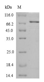Recombinant Escherichia coli Chaperone protein HtpG(htpG)