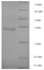 Recombinant Escherichia coli Crossover junction endodeoxyribonuclease RuvC(ruvC)