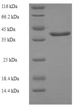 Recombinant Escherichia coli Cytidylate kinase(cmk)