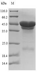 Recombinant Escherichia coli Cytolethal distending toxin subunit B(cdtB)
