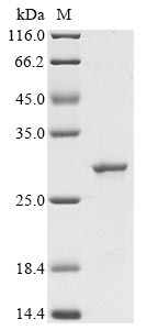 Recombinant Escherichia coli Cytolethal distending toxin subunit C(cdtC)