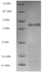 Recombinant Escherichia coli Holliday junction ATP-dependent DNA helicase RuvA(ruvA)