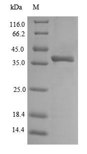 Recombinant Escherichia coli O157:H7 Outer membrane protein A(ompA),partial