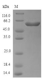 Recombinant Escherichia coli O6:H1 Exopolyphosphatase(ppx)