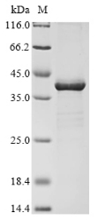 Recombinant Escherichia coli O6:H1 Probable L,D-transpeptidase YbiS(ybiS)