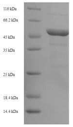 Recombinant Escherichia coli Outer membrane protein C(ompC)
