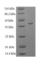 Recombinant Escherichia coli Protease 7(ompT)