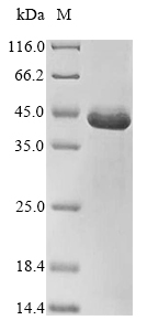 Recombinant Escherichia coli RNA polymerase sigma factor RpoH(rpoH)