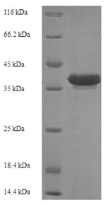 Recombinant Escherichia coli Recombination protein RecR(recR)