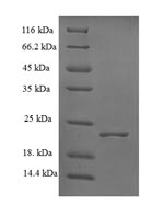 Recombinant Escherichia coli S-ribosylhomocysteine lyase(luxS)