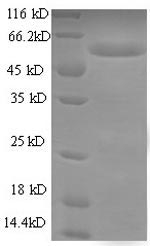 Recombinant Escherichia coli Type 1 fimbrin D-mannose specific adhesin(fimH)